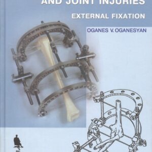 Лечение переломов костей и повреждение суставов (на англ. языке)